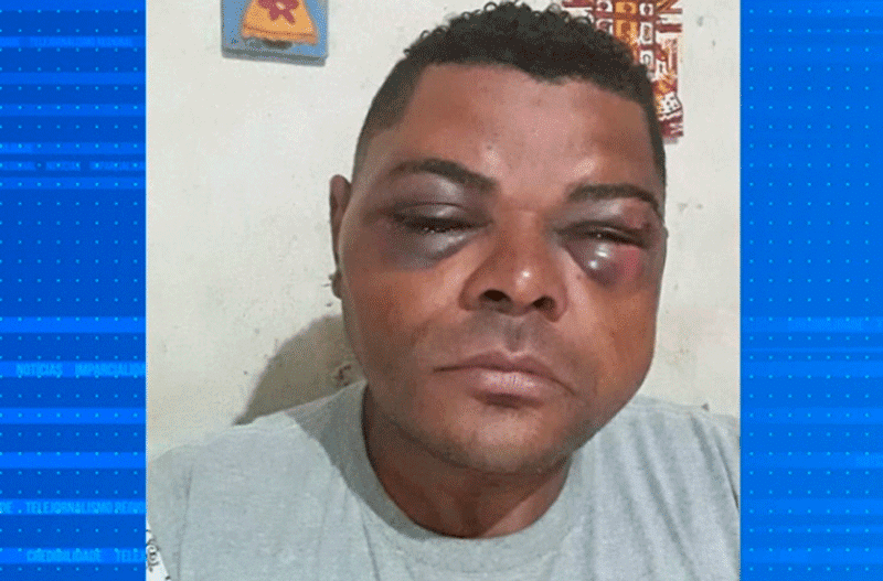 Homem diz ter sido agredido na UPH da Zona Norte em Sorocaba