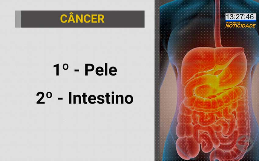 41 mil novos casos de câncer de intestino em 2020