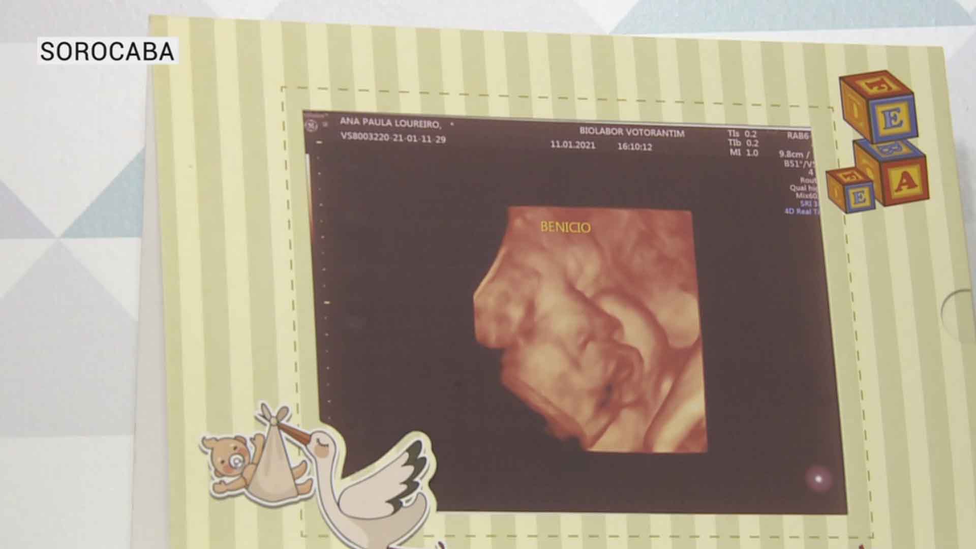 ultrassom bebe