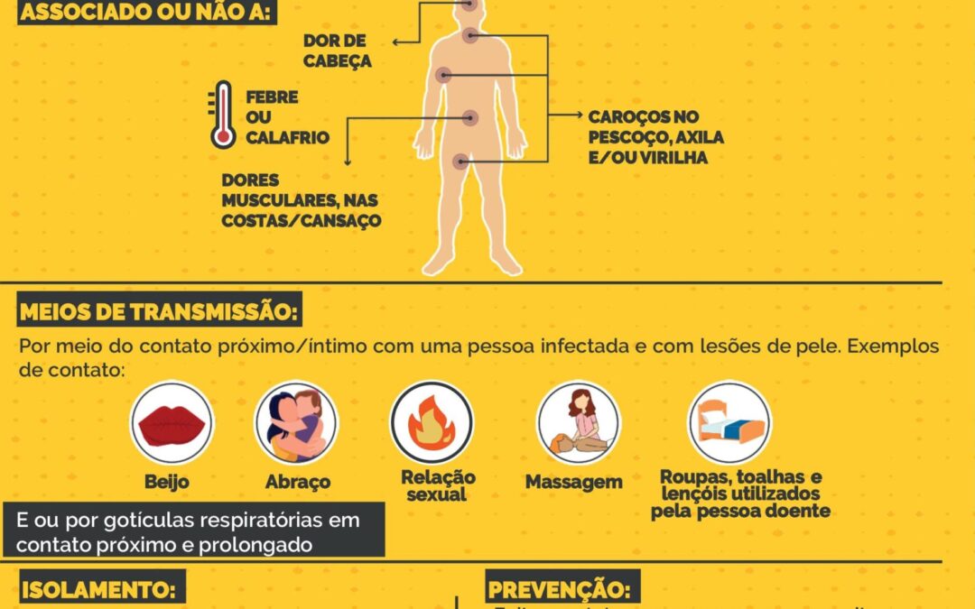 Jundiaí confirma primeiro caso de mpox em 2026