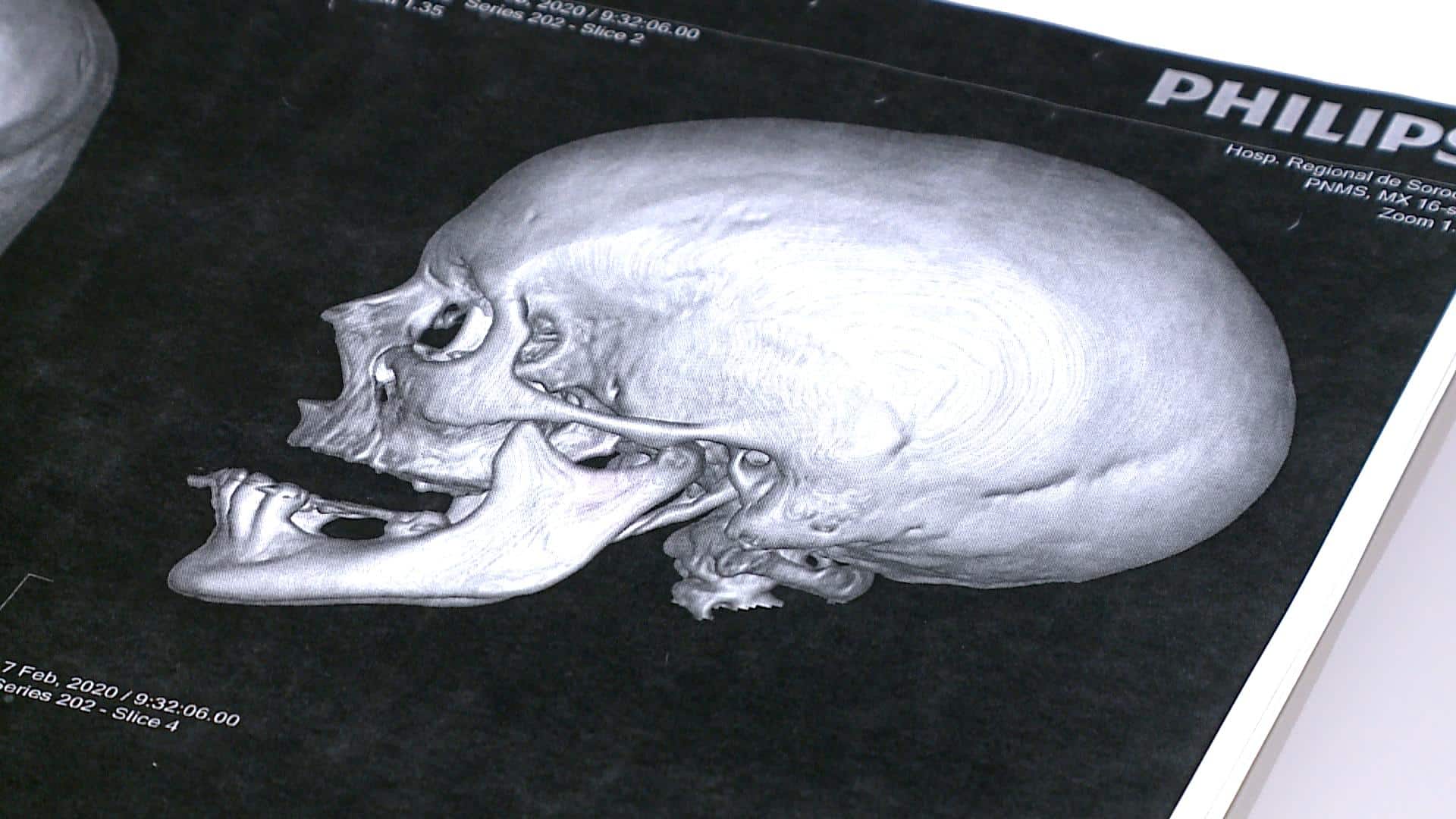 Raio-x de crânio humano.