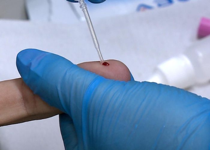 Viva com Saúde: Julho Amarelo é o mês que conscientiza sobre as hepatites virais
