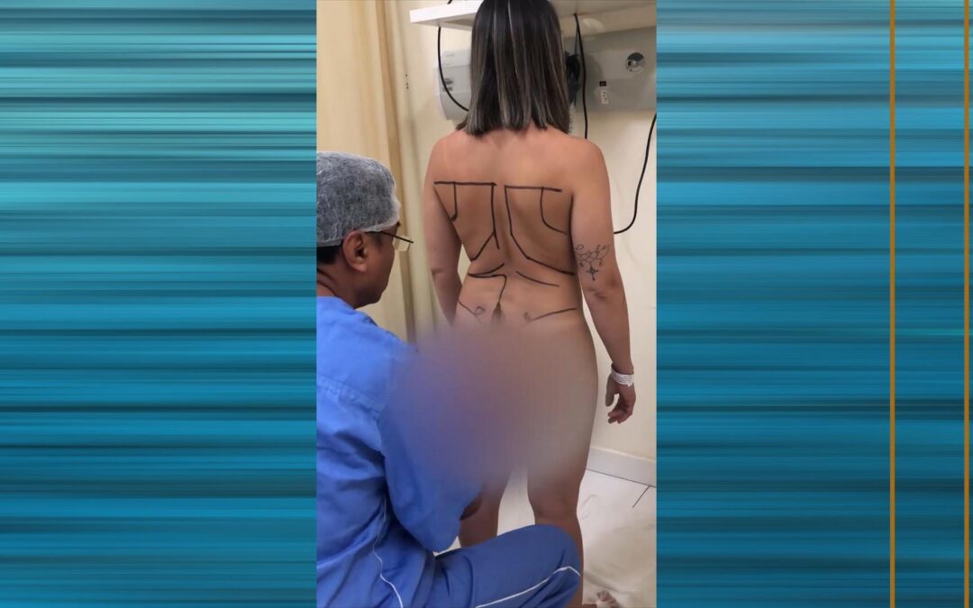 Cirurgia plástica exige escolha consciente, alertam especialistas