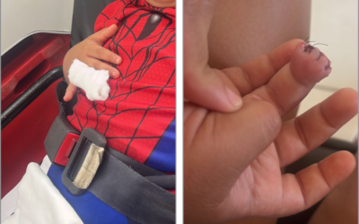 Criança de 4 anos tem ponta de dedo amputada após acidente com porta em escola de Sorocaba