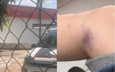 Homem é preso após agredir brutalmente jovem de 19 anos em Votorantim