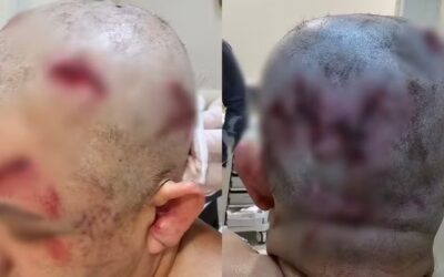 Homem recebe mais de 16 anos de prisão por tentar matar ex-companheira com marreta em Boituva