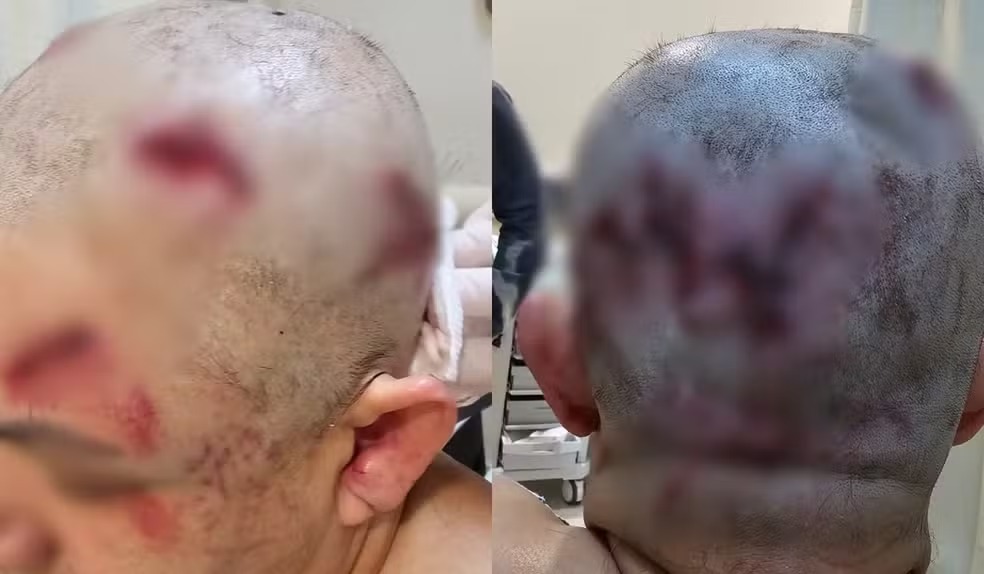 Homem recebe mais de 16 anos de prisão por tentar matar ex-companheira com marreta em Boituva