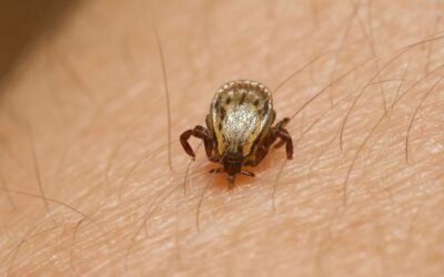 Morte por febre maculosa é confirmada em Várzea Paulista