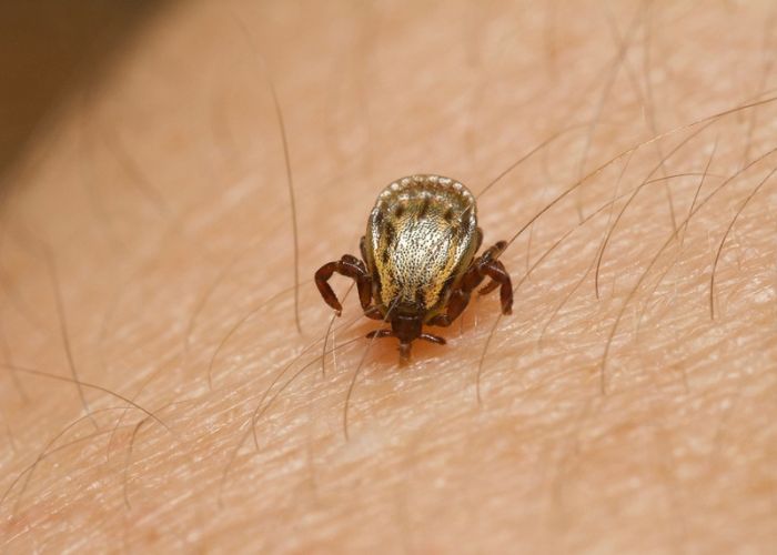Morte por febre maculosa &eacute; confirmada em V&aacute;rzea Paulista